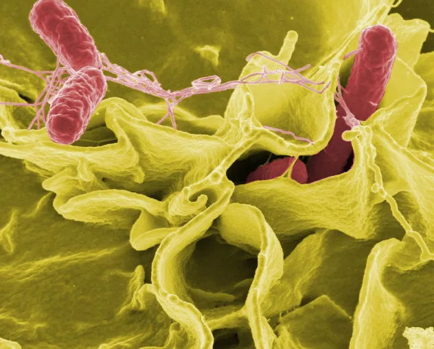 Gastroenteritis typically occurs when your immune system activates an inflammatory response to defend your digestive tract against harmful bacteria such as Salmonella