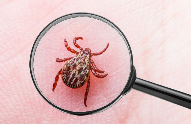 Encephalitis Virus or Lyme Disease Infected Tick Arachnid Insect on Skin for the article about Doxycycline Online for Lyme