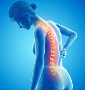 Image of a female highlighting her spine for the blog post about Telehealth Osteoporosis Screening