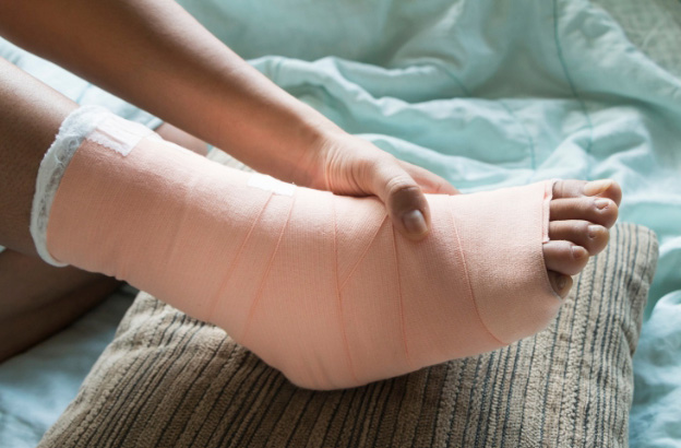 Photo of foot soft splint to treatment of tendon injury for the blog post on advanced tendon healing protocols